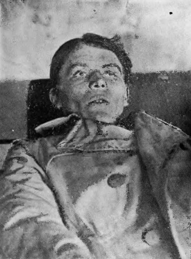 Ein altes Schwarz-Weiß-Foto eines Mannes im Krankenhausbett, der besorgt mit weit aufgerissenen Augen, leicht geöffnetem Mund und gefalteten Händen dasitzt.