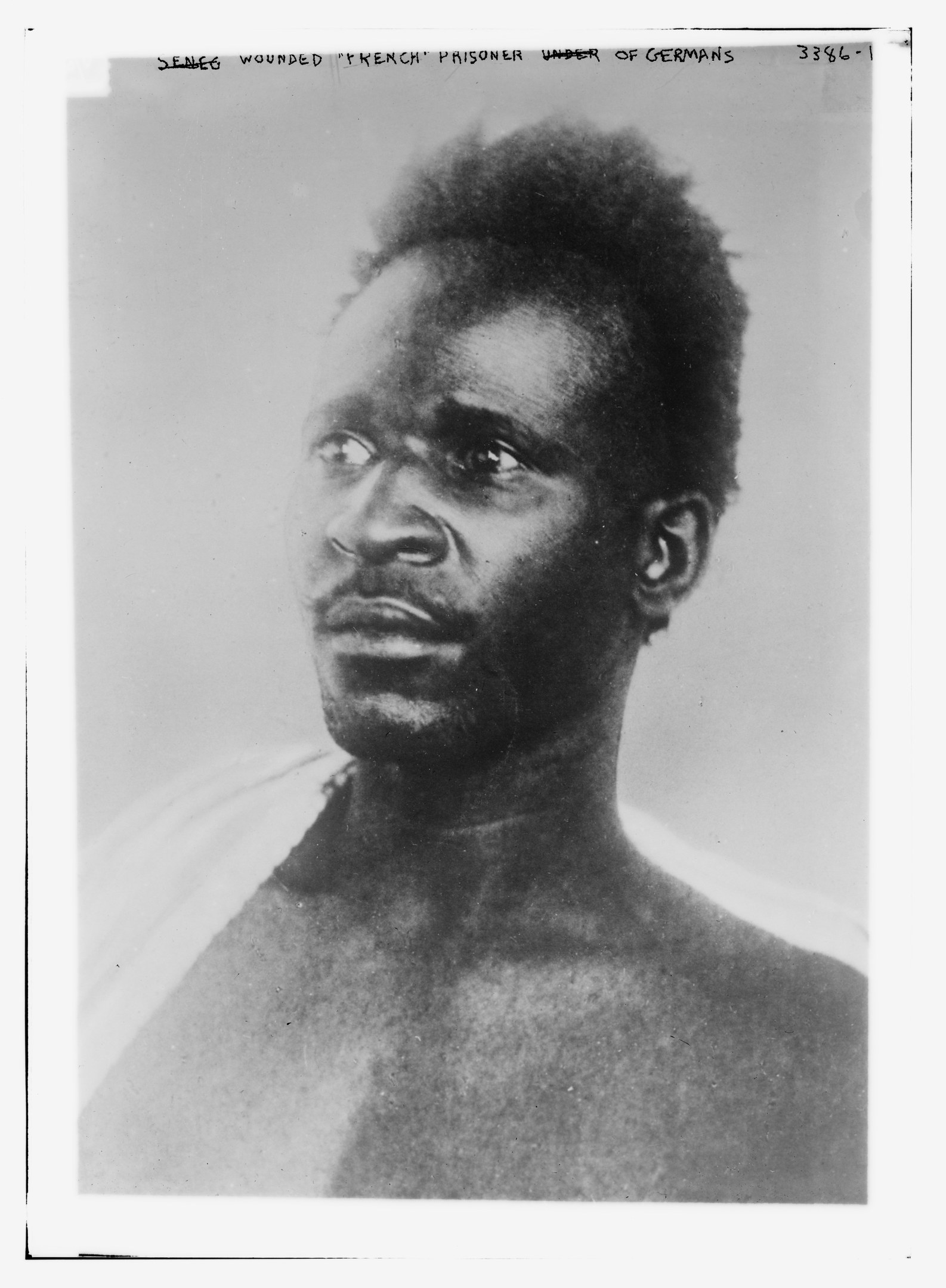 Schwarzes und weißes Foto eines Mannes mit ernstem Gesichtsausdruck, beschriftet mit 'Seneg Verletzter französischer Gefangener unter Deutschen' oben.