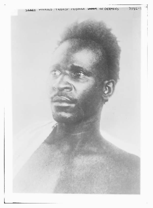 Schwarzes und weißes Foto eines Mannes mit ernstem Gesichtsausdruck, beschriftet mit 'Seneg Verletzter französischer Gefangener unter Deutschen' oben.
